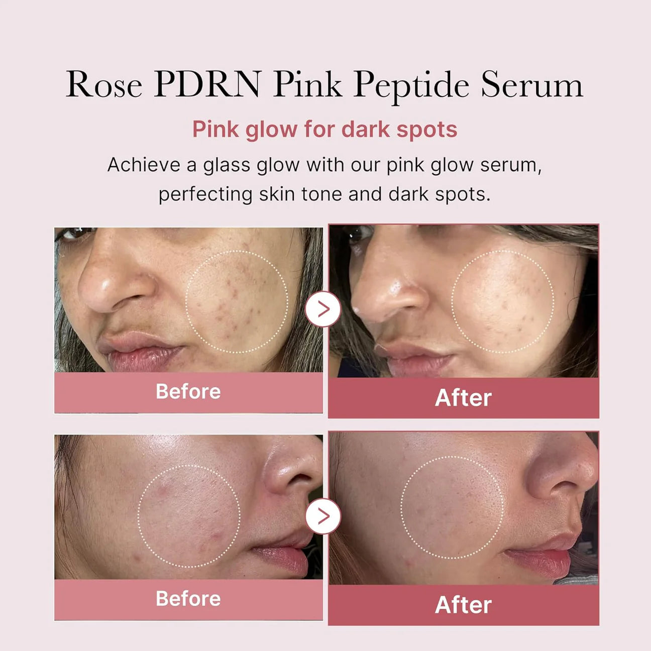 PDRN Pink Peptide Serum 30ml