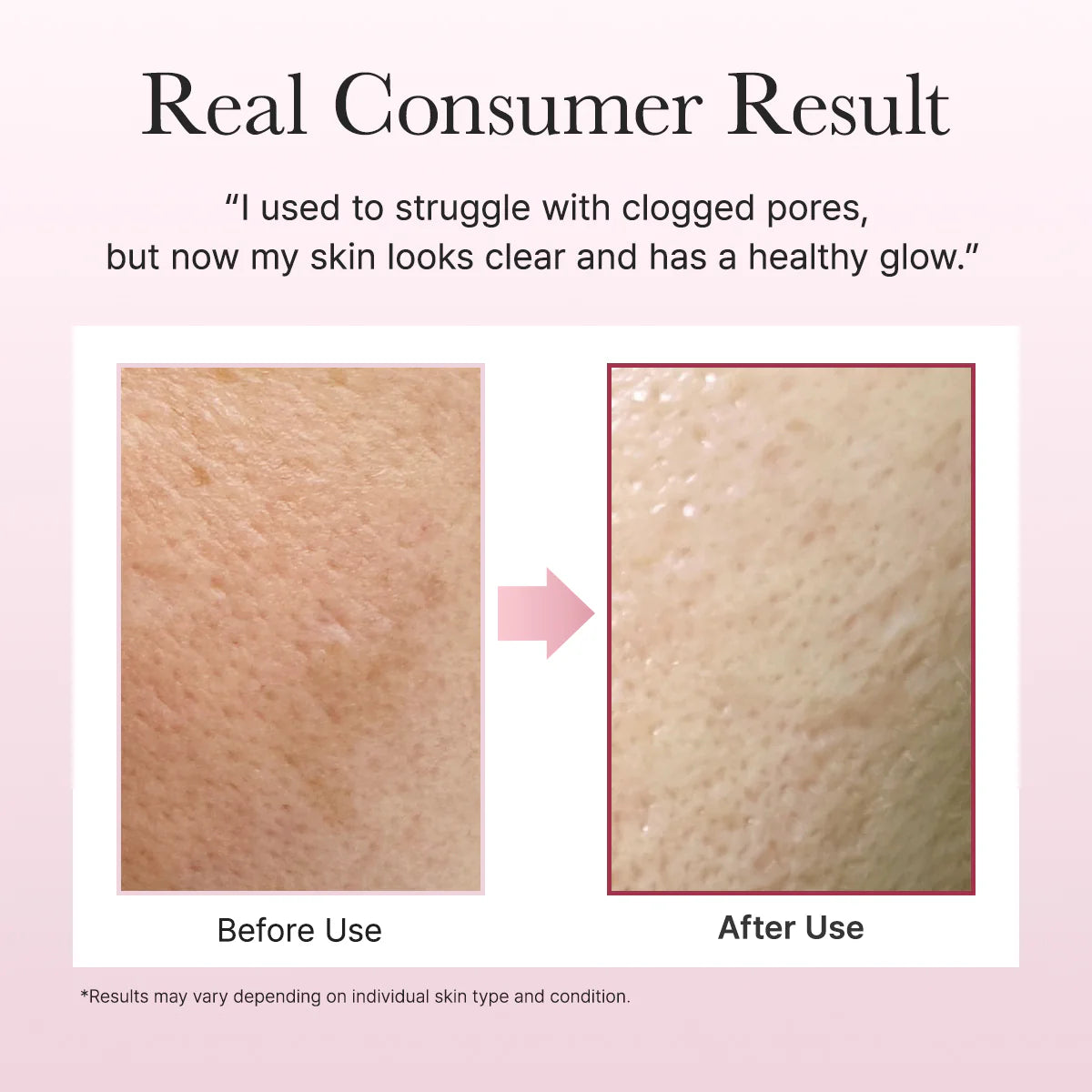 Arencia Fresh Rosehip Mochi Cleanser